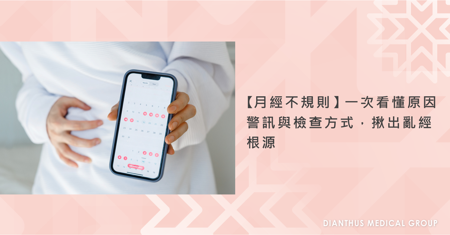 月經不規則